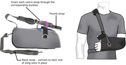 SMALL - Arm Sling / Immobiliser
